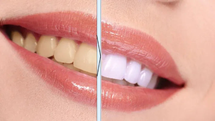 Smile Brightening Pen